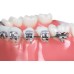 Bracket Guard Elastic - Silver - PK/100